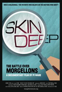 دانلود مستند Skin Deep: The Battle Over Morgellons 2019104233-1389631031